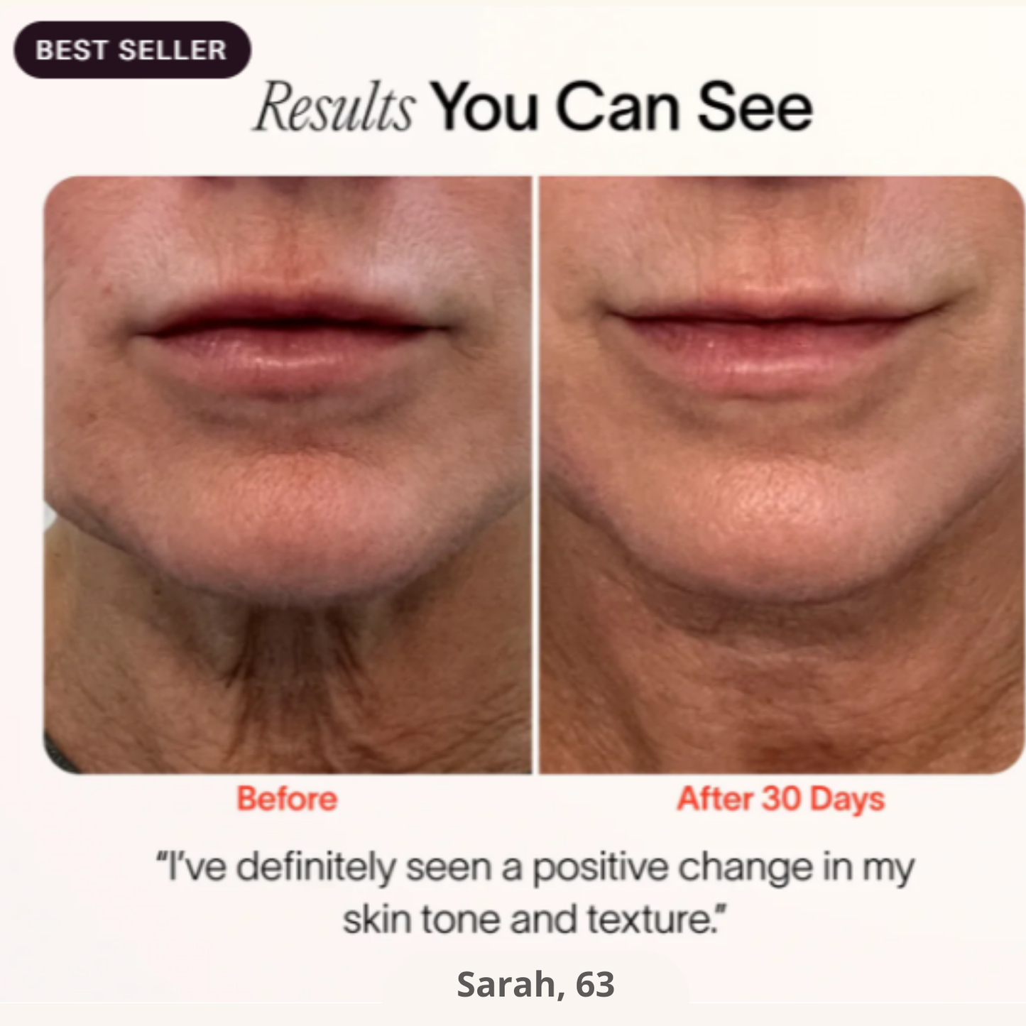 Skincare Wand 4-in-1