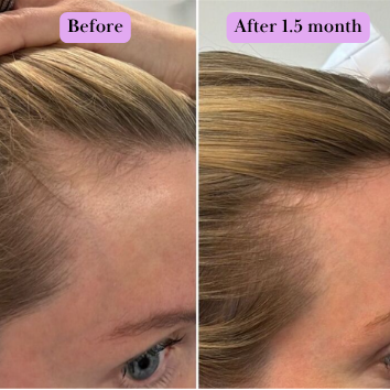 Hair Generating Rolling Fluid
