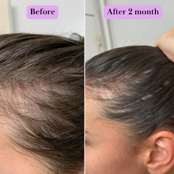 Hair Generating Rolling Fluid