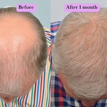 Hair Generating Rolling Fluid